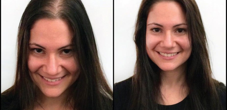 Extensions With Thin Hair