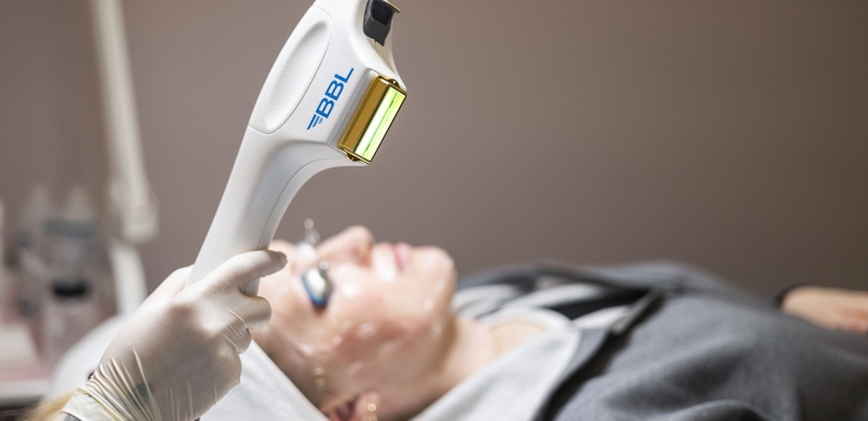 Laser Treatment For Wrinkles Altamonte Springs