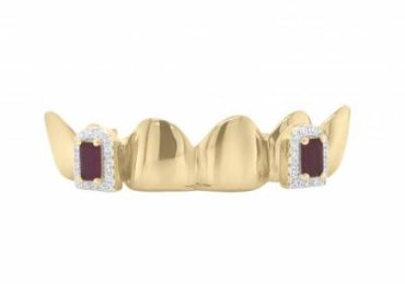 Exotic Diamonds – Get your customized Teeth Grill (San Antonio, Texas, USA)