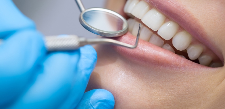 Dental Implants River Oaks