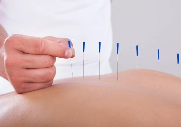 Acupuncture Clinic NYC