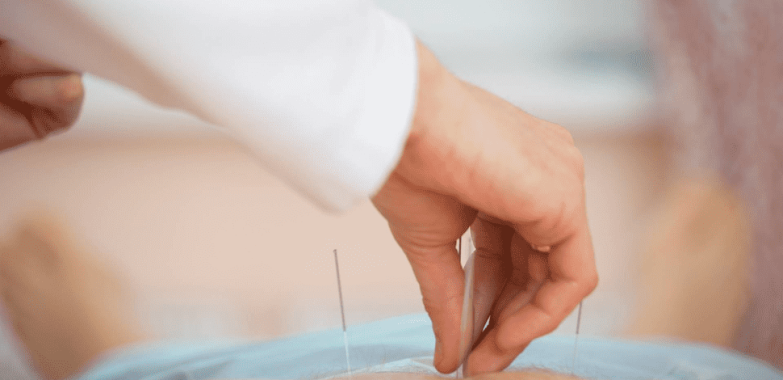 Acupuncture Clinic NYC