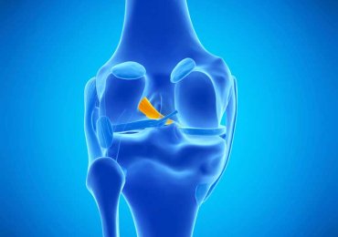 Affordable ACL Ligament Surgery In Dubai