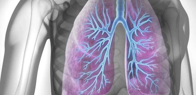 Affordable Asthma Natural Treatment