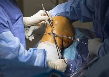 Best Doctor for ACL Ligament Surgery in Jaipur