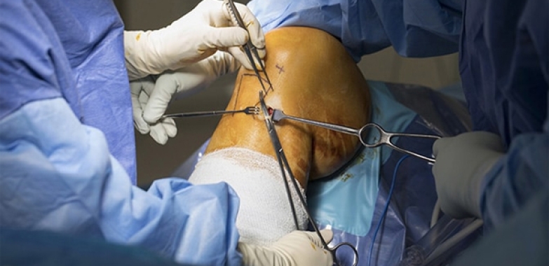 Best Doctor for ACL Ligament Surgery in Jaipur