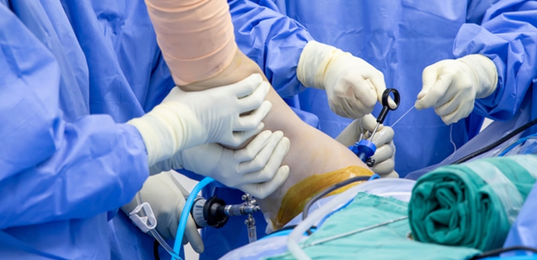 Best knee Arthroscopic Surgery In Jaipur