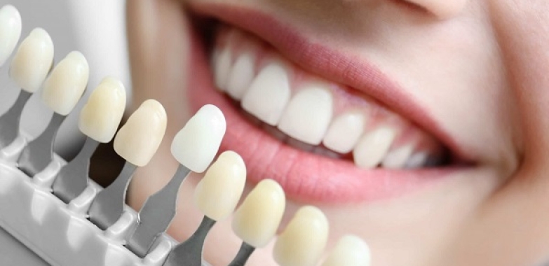 Sunny Isles Dental