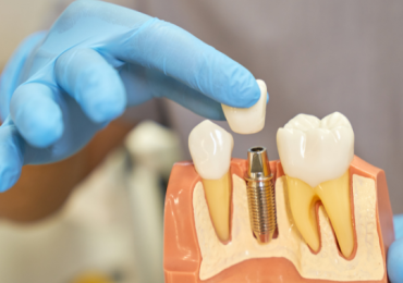 Best Dental Clinic in Yelahanka, Bangalore | Best Dentist In Yelahanka | Dental Sage