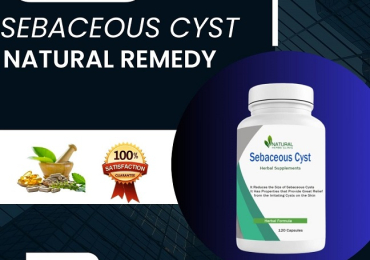Home Removal of Sebaceous Cyst