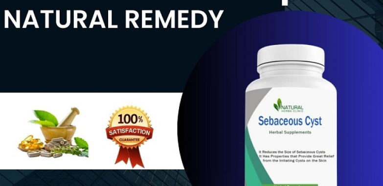 Home Removal of Sebaceous Cyst