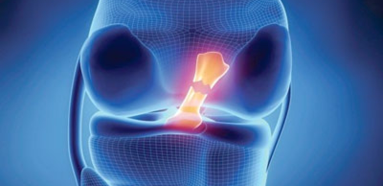 Knee Ligament Treatment in Delhi