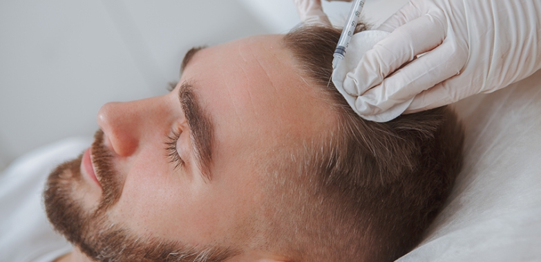 Can a Failed Hair Transplant Be Repaired Successfully?