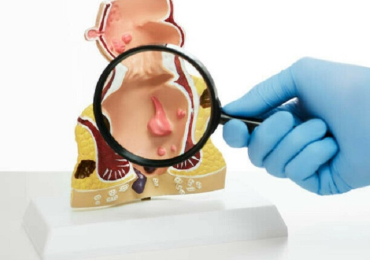 Piles Doctor in Faridabad