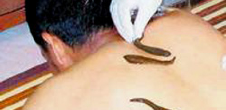 Best Leech Therapy in Ghaziabad