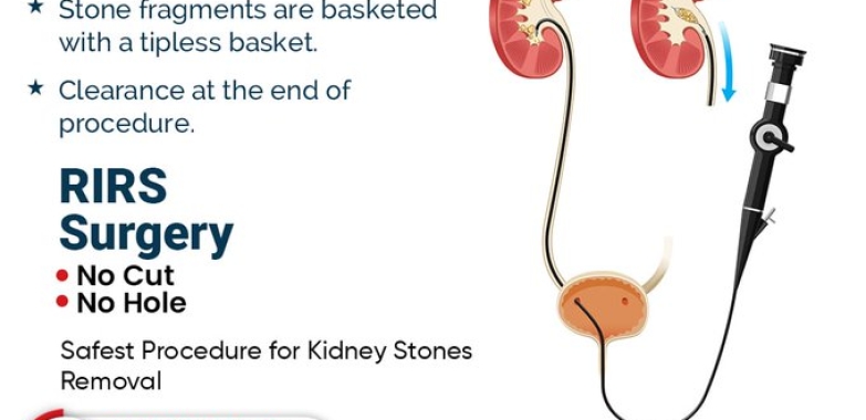 Khosla Stone Kidney & Surgical Centre | Kidney Hospital In Punjab
