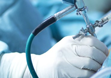 Best Arthroscopy Surgery In Rajasthan