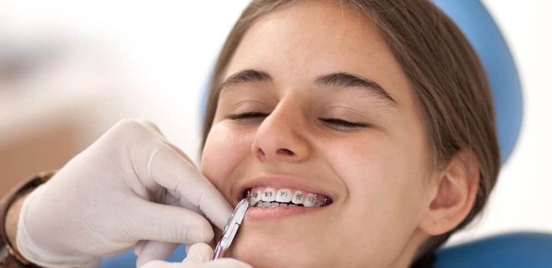 Braces Treatment in Bhopal | Get Straight Teeth with Smile Gallery