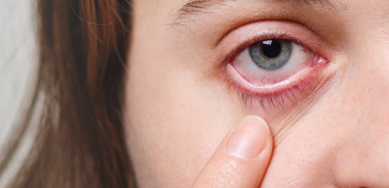 Vaping and Eye Floaters: Examining the Possible Associations