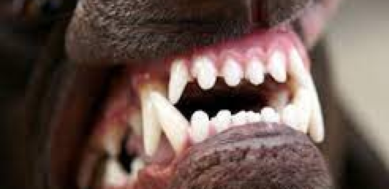 Dog Bite Lawyer