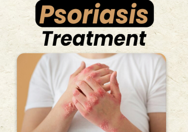 Say Goodbye to Psoriasis: Innovative Solutions for Skin and Scalp