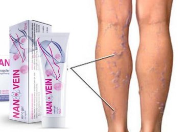 Cream for varicose veins NanoVein